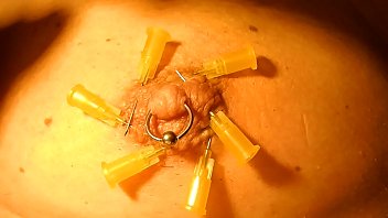 little needles in areola